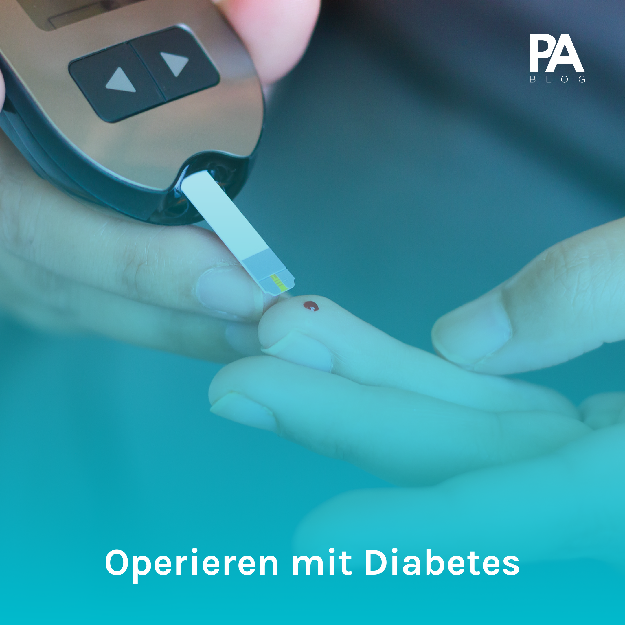 Operieren mit Diabetes